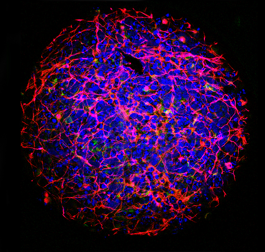 Mikroskopiebild eines kugelförmigen "Minigehirns" (ca.0.5 mm Durchmesser), aus Neuronen und weiteren Zelltypen im Labor erzeugt. ©CAAT, JOHNS HOPKINS Bloomberg School of Public Health