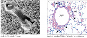 Images of the lung taken with (A) a Scanning Electron Microscope or (B) light microscope showing the airways (AW) and surrounding alveoli (AL). Arrows indicate inhaled agglomerates of carbon black nanoparticles (CBNP).