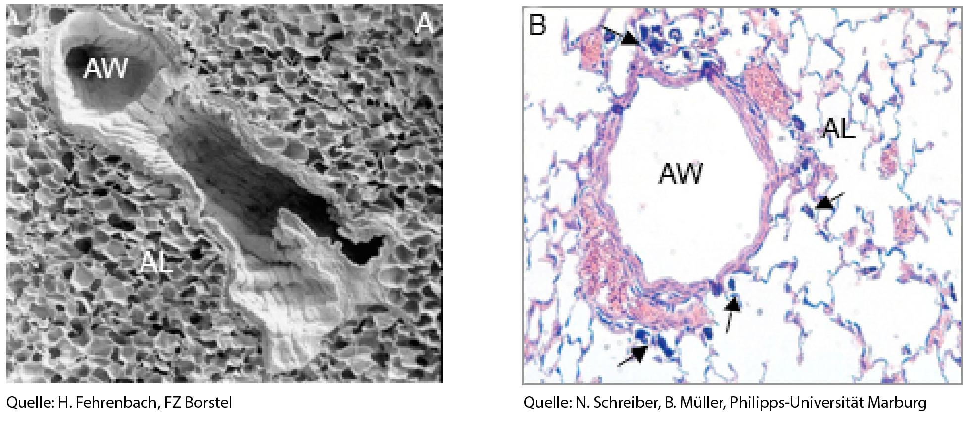 Querschnitte durch die Lunge (links) und eine Alveole (rechts) von Versuchstieren, die im Versuch Carbon Black Nanopartikel eingeatmet haben. 