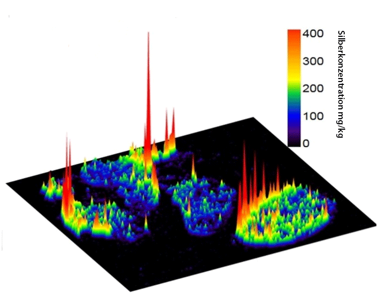 Three-dimensional image showing the local distribution of silver in lymph nodes